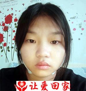 雷林