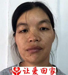 潘玲