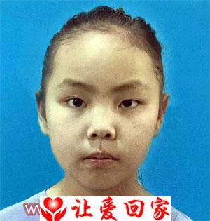 张婉琪